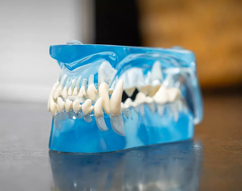 seet of teeth